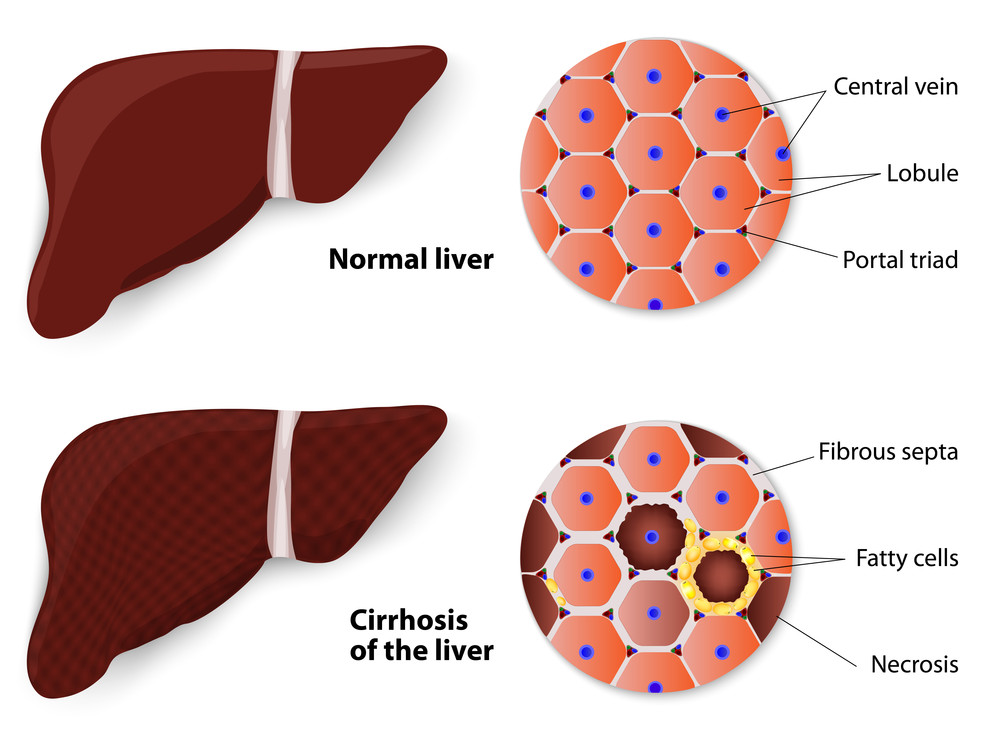 Liver Specialist Doctor in Ahmedabad